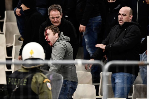 Tới Hy Lạp xem bóng đá, CĐV Hà Lan bị đánh chảy máu đầu, bị tấn công dã man bằng bom xăng, pháo sáng - Ảnh 8.