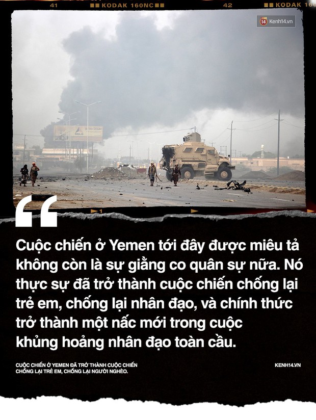 Amal Hussain: Biểu tượng nạn đói Yemen và sứ mệnh hy sinh cho cả dân tộc trên vai những đứa trẻ - Ảnh 3.