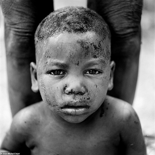 Tục lệ khắc dấu lên đầu trẻ em để đánh dấu thành viên gia tộc ở Châu Phi khiến ai chứng kiến cũng rùng mình - Ảnh 10.