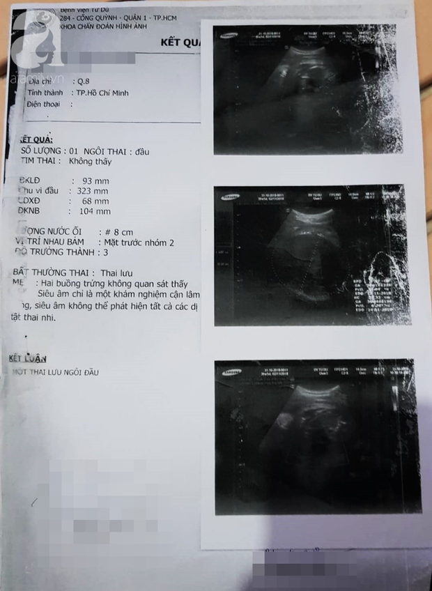 Bệnh viện Từ Dũ công bố nguyên nhân vụ thai phụ 24 tuổi bị mất con sắp sinh: Do đột tử - Ảnh 5.