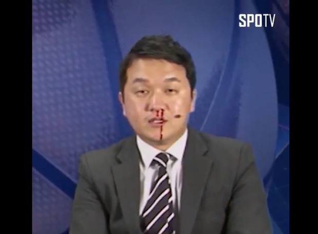 Lỗ mũi ăn trầu vẫn bình tĩnh dẫn chương trình, MC thể thao Hàn Quốc khiến Internet không thể nhịn cười - Ảnh 3.
