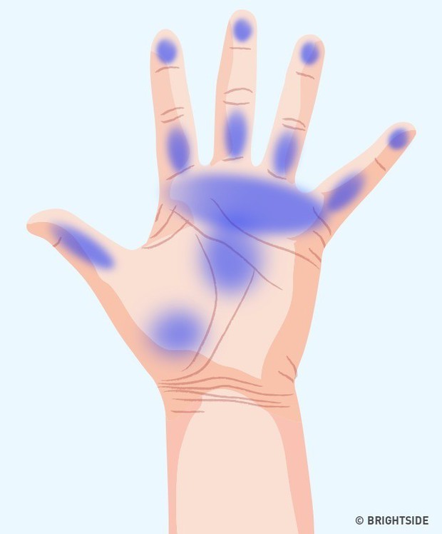 Bàn tay đột nhiên tê buốt ở các điểm này là dấu hiệu bạn không nên xem thường - Ảnh 7.