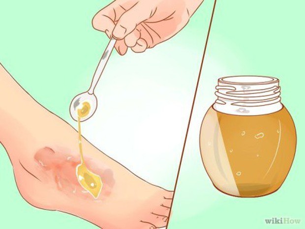 Tin được không: viên đường giúp vết thương mau lành ngay cả khi thuốc kháng sinh đã “bó tay”? - Ảnh 3.