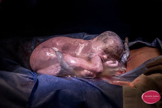 "Fierce" yet beautiful birth photos show that women are truly great mother bears - Photo 17.