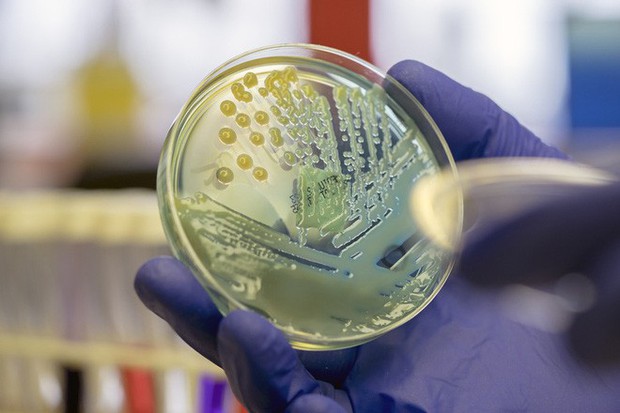 Báo cáo mới nhất về tình hình kháng kháng sinh tại Mỹ: Siêu vi khuẩn lây lan ngoài sức tưởng tượng - Ảnh 1.