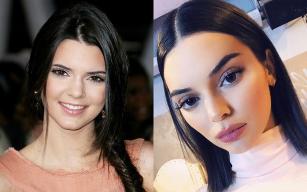 Hành trình bơm môi sửa mặt của Kendall: Từ thiên thần trong sáng thành mỹ nhân gợi cảm - Ảnh 18.