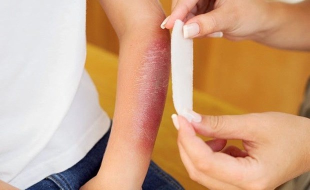 Dây thần kinh của bạn có thể đang gặp vấn đề nếu xuất hiện những dấu hiệu sau - Ảnh 7.
