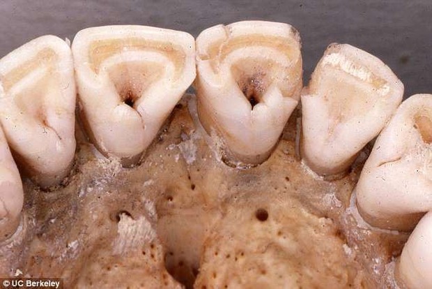 Răng sữa hình xẻng - điểm tiến hóa này chỉ có ở người Đông Á và thổ dân châu Mỹ, nhưng bất ngờ nhất là... - Ảnh 5.