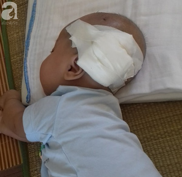 Tiếng khóc xé lòng của bé trai hơn 5 tháng tuổi mắc bệnh não úng thủy - Ảnh 2.