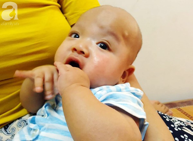 Tiếng khóc xé lòng của bé trai hơn 5 tháng tuổi mắc bệnh não úng thủy - Ảnh 4.