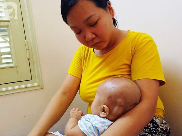 Tiếng khóc xé lòng của bé trai hơn 5 tháng tuổi mắc bệnh não úng thủy - Ảnh 6.