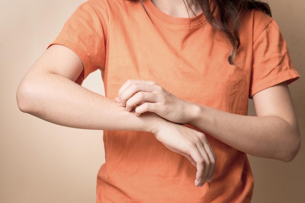 Đây là những vấn đề sức khỏe bạn sẽ gặp phải nếu mặc quần áo ướt đẫm mồ hôi quá lâu vào mùa hè - Ảnh 3.