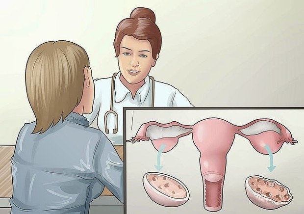 Những nguyên nhân không ngờ khiến con gái đột ngột mất kinh nguyệt - Ảnh 4.