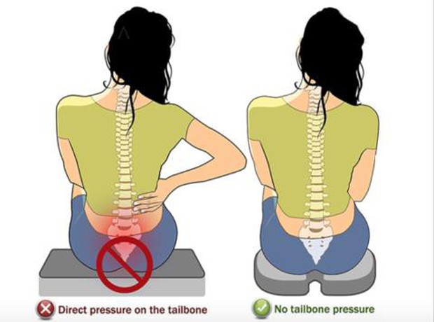 Chơi trượt nước về thấy... đau mông dữ dội: có thể bạn đã chấn thương ở bộ phận ít ai ngờ đến - Ảnh 3.
