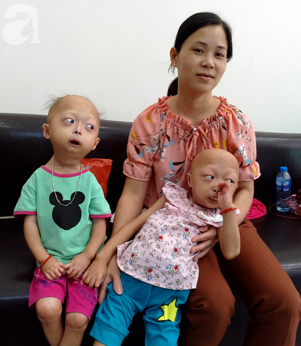 Mẹ của 2 bé gái bị đầu, cổ vẹo lệch ở Tuyên Quang: Giá như con khỏi bệnh, dù đánh đổi gì tôi cũng cam lòng - Ảnh 2.