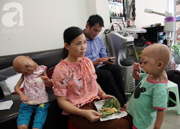 Mẹ của 2 bé gái bị đầu, cổ vẹo lệch ở Tuyên Quang: Giá như con khỏi bệnh, dù đánh đổi gì tôi cũng cam lòng - Ảnh 4.