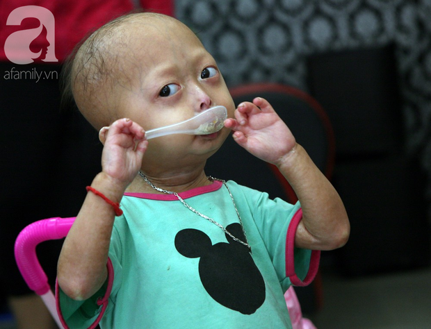 Mẹ của 2 bé gái bị đầu, cổ vẹo lệch ở Tuyên Quang: Giá như con khỏi bệnh, dù đánh đổi gì tôi cũng cam lòng - Ảnh 7.