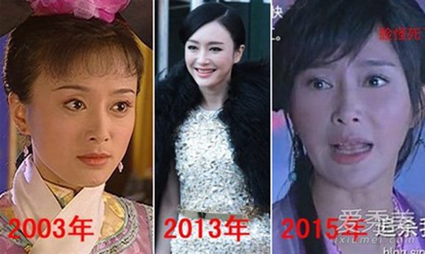Tần Lam - Hoàng Hậu của Diên Hi Công Lược từng bỏ rơi Huỳnh Hiểu Minh lúc đau ốm, đối diện với nghi vấn thẩm mỹ - Ảnh 28.