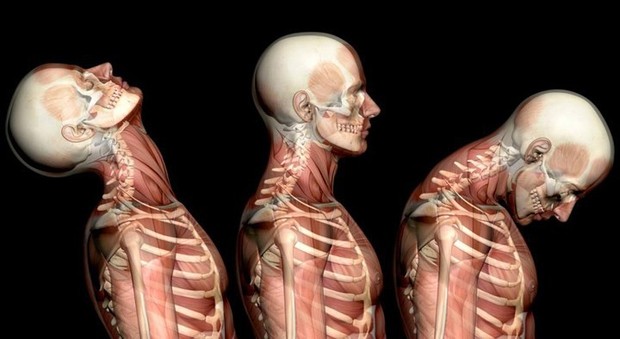 Nguyên nhân thường gặp của đau cổ - Ảnh 3.