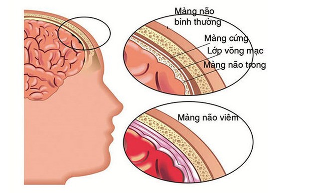 Nguyên nhân thường gặp của đau cổ - Ảnh 6.