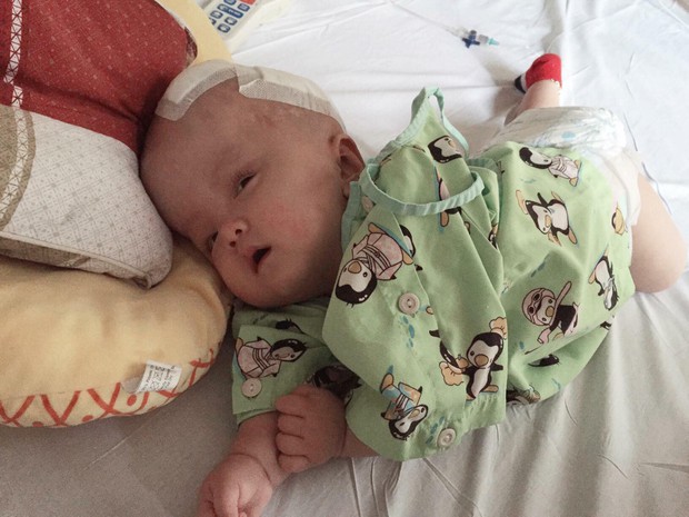 Thiếu kinh phí phẫu thuật cho con trai bị não úng thủy đang điều trị tại Singapore, người mẹ ôm con quỳ gối cầu cứu sự giúp đỡ - Ảnh 3.