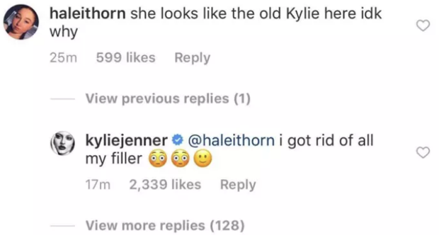 Nữ hoàng môi tều Kylie Jenner giờ môi đã không còn tều, tự nhận đã rút hết filler ra khỏi môi và đây là phản ứng của cư dân mạng - Ảnh 4.