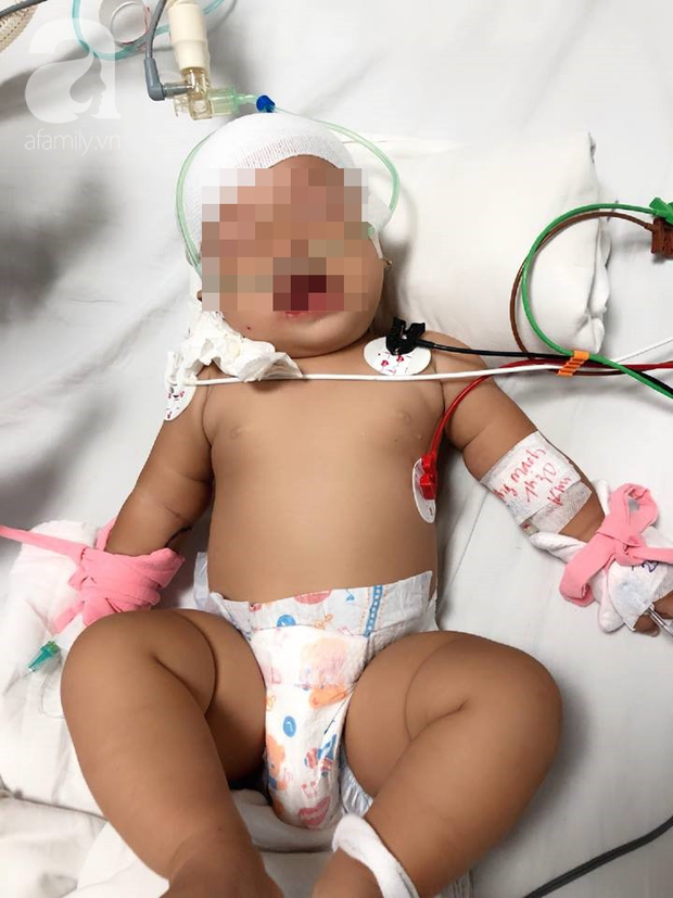 TP.HCM: Bé gái bị khỉ nhà hàng xóm cắn lún sọ đã được về nhà - Ảnh 1.