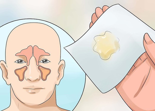 Sáng ngủ dậy gặp phải những dấu hiệu này thì nên chủ động đi kiểm tra sức khỏe ngay - Ảnh 4.