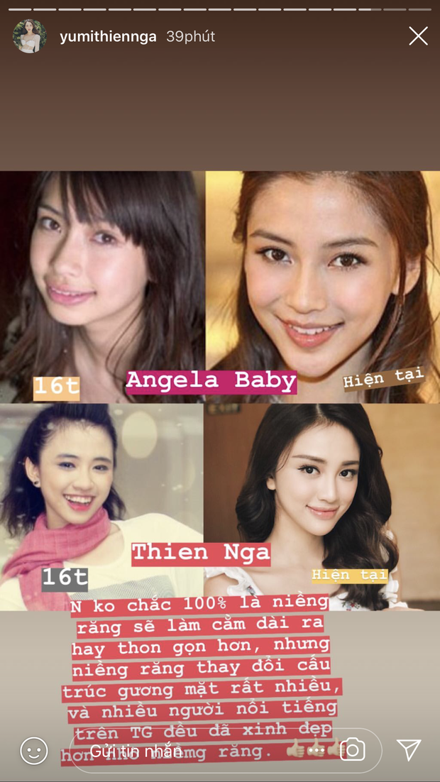 Thiên Nga tự so sánh mình với Angela Baby khi bị truy sát với câu hỏi có phẫu thuật thẩm mỹ hay không? - Ảnh 4.