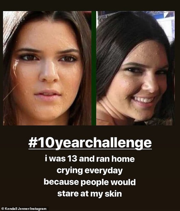 Hãng mỹ phẩm trị mụn cuối cùng đã phản ứng sau vụ thảm họa quảng cáo khiến Kendall Jenner hứng gạch đá - Ảnh 2.
