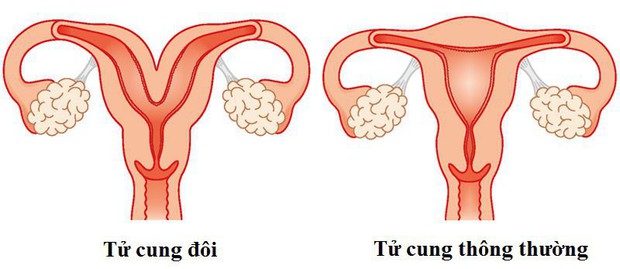 Chịu đựng cơn đau suốt 10 năm, sau lần đầu tiên quan hệ bất thành, cô gái mới biết mình mắc phải chứng bệnh hiếm gặp - Ảnh 3.