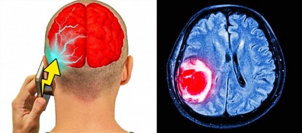 4 vị trí không nên đặt điện thoại nhưng nhiều người vẫn làm sai có thể gây nguy cơ vô sinh - Ảnh 1. 4 vị trí không nên đặt điện thoại nhưng nhiều người vẫn làm sai có thể gây nguy cơ vô sinh - Ảnh 1.