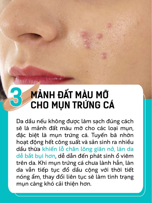 Da dầu vui thì ít, khổ thì nhiều và đây là top 5 điều nhức nhối nhất - Ảnh 4.