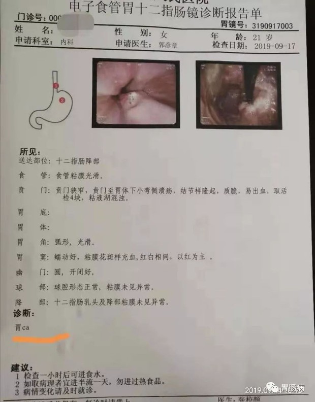 Cô gái chỉ mới 21 tuổi đã mắc bệnh ung thư, nguyên nhân đến từ thói quen thường gặp phải ở giới trẻ - Ảnh 1.