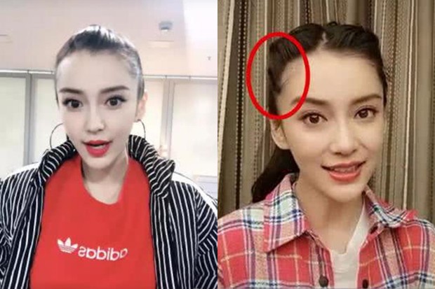 Vấn nạn rụng tóc của minh tinh showbiz: Dương Mịch - Angela Baby lộ trán hói, sao nam đáng lo ngại chẳng kém - Ảnh 11.