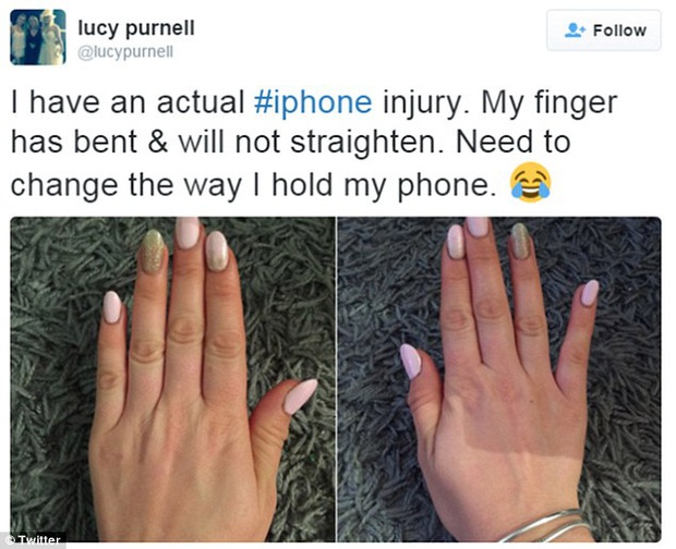 Hãy thử so sánh hai bàn tay của mình xem bạn có bị cong vẹo cả ngón tay vì thói quen sử dụng điện thoại lâu hay không - Ảnh 1.