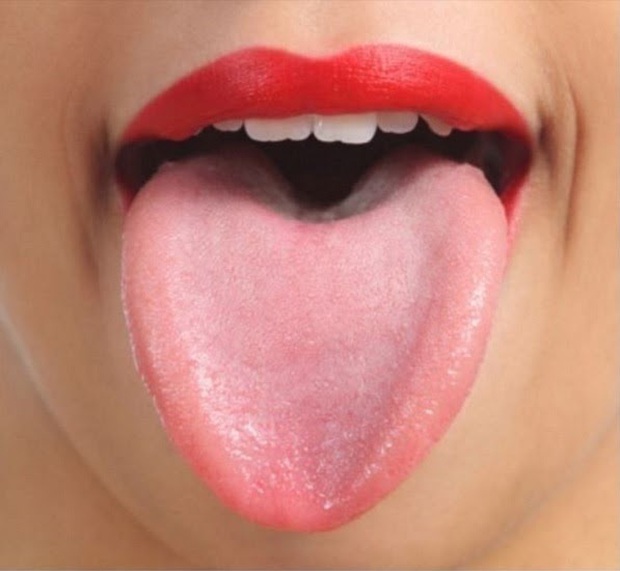 Nếu lưỡi bạn có những biểu hiện sau, đừng chủ quan, có thể bạn đang có một số vấn đề về sức khỏe! - Ảnh 1.