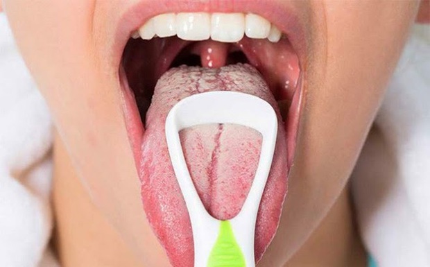 Nếu lưỡi bạn có những biểu hiện sau, đừng chủ quan, có thể bạn đang có một số vấn đề về sức khỏe! - Ảnh 2.