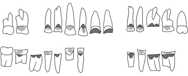 Từ một cái răng 4000 năm tuổi, khoa học giải quyết được câu hỏi khó nhất trong ngành khảo cổ: người chết đã từng làm nghề gì? - Ảnh 1.