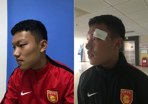 Sự cố cầu thủ U17 Hà Nội tung đấm vào mặt đồng nghiệp: BTC giải đấu ở Trung Quốc ra án phạt nặng - Ảnh 2.