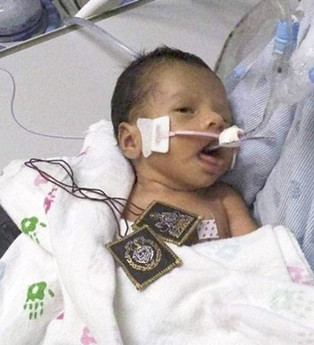 Vụ sát hại mẹ bầu cướp thai nhi: Em bé đã mở mắt, gia đình không rút ống thở mà vẫn chờ đợi một phép màu - Ảnh 2.