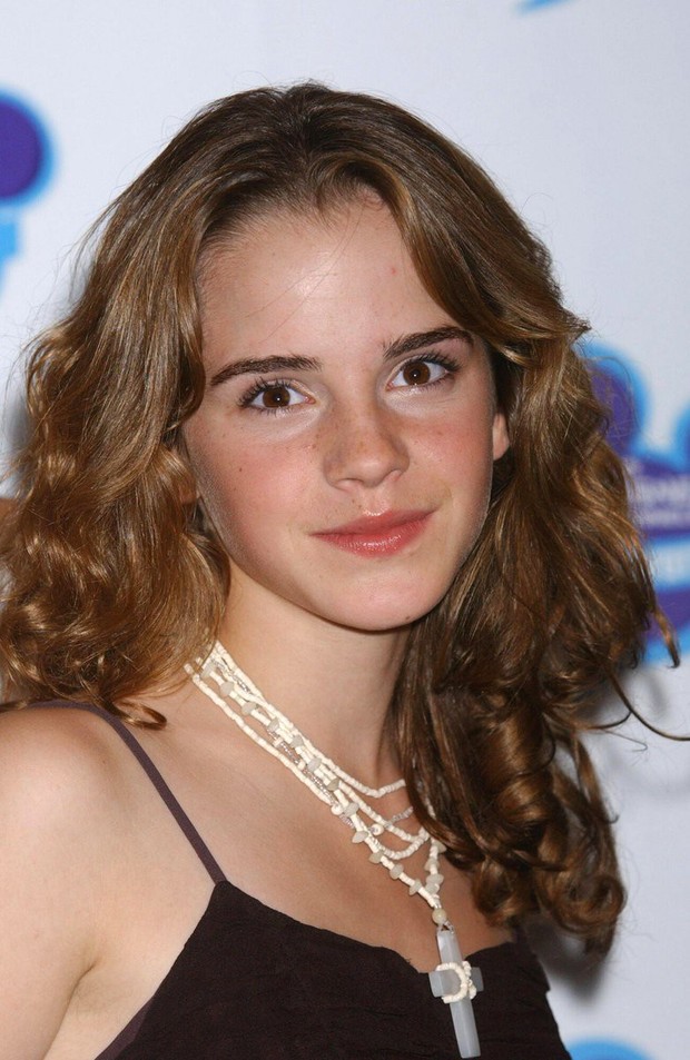 Emma Watson's journey of beauty decline after 18 years: Who would have thought the most beautiful flower in England would fade so quickly - Photo 2.