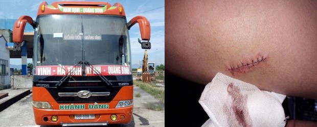 Nhóm đối tượng chém phụ xe, cướp hàng hóa rồi bỏ trốn - Ảnh 1.