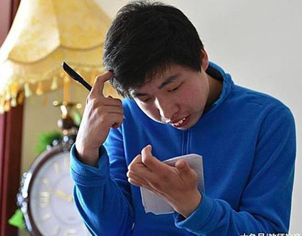 Cậu bé bại não trở thành thiên tài toán học - Ảnh 2.