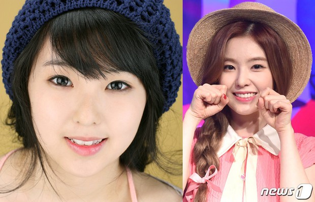 Irene (Red Velvet) cũng sứ hóa hàm răng nhưng không cần dùng cách phải mài răng bé xíu mà vẫn đẹp - Ảnh 3.