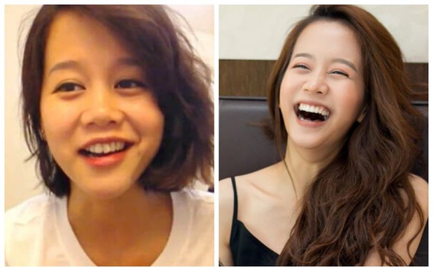 Đâu chỉ có ở Hàn, showbiz Việt cũng có cả loạt sao lột xác, khoe nụ cười đắt giá nhờ thẩm mỹ răng - Ảnh 14.