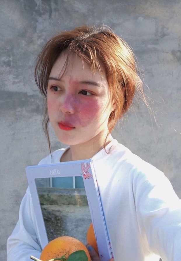 Hot girl với vết chàm lớn trên mặt trở thành mẫu lookbook nổi tiếng: Con gái xinh nhất khi tự tin là chính mình! - Ảnh 1. Hot girl với vết chàm lớn trên mặt trở thành mẫu lookbook nổi tiếng: Con gái xinh nhất khi tự tin là chính mình! - Ảnh 1.