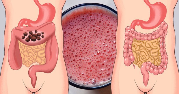 Những cách đơn giản giúp làm sạch đại tràng một cách tự nhiên mà bạn không nên bỏ qua - Ảnh 2. Những cách đơn giản giúp làm sạch đại tràng một cách tự nhiên mà bạn không nên bỏ qua - Ảnh 2.