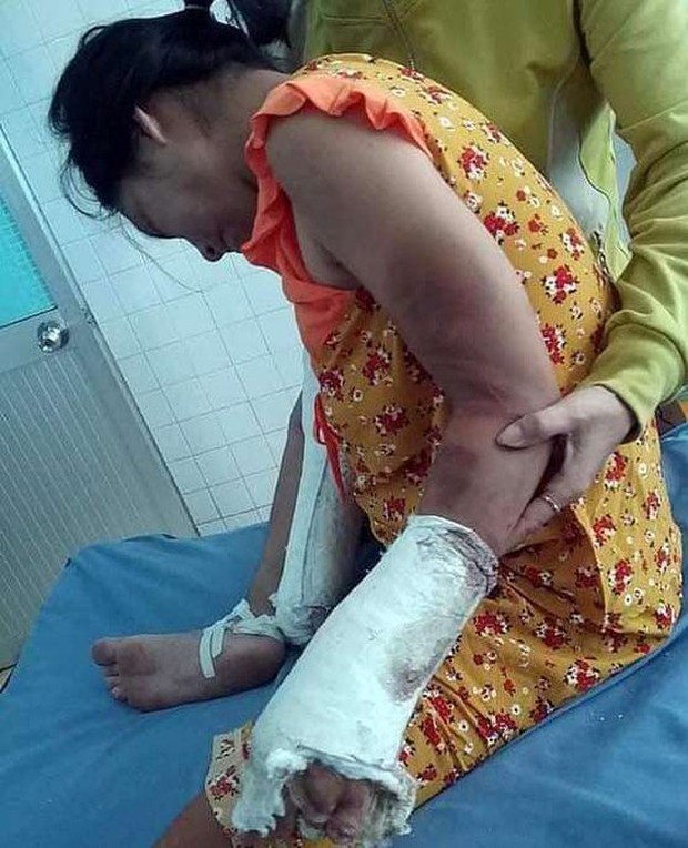 Bắt gã chồng hờ hành hạ dã man thai phụ ở Bình Thuận - Ảnh 2.