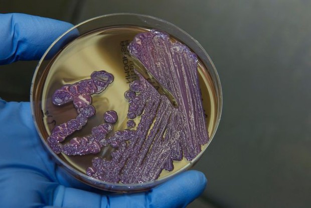 Giải đáp tất tần tật thông tin về bệnh nhiễm khuẩn ăn thịt người - Whitmore, đặc biệt lưu ý cách phòng ngừa - Ảnh 4.